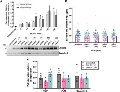 Dynamic but discordant alterations in zDHHC5 expression and palmitoylation of its substrates in cardiac pathologies